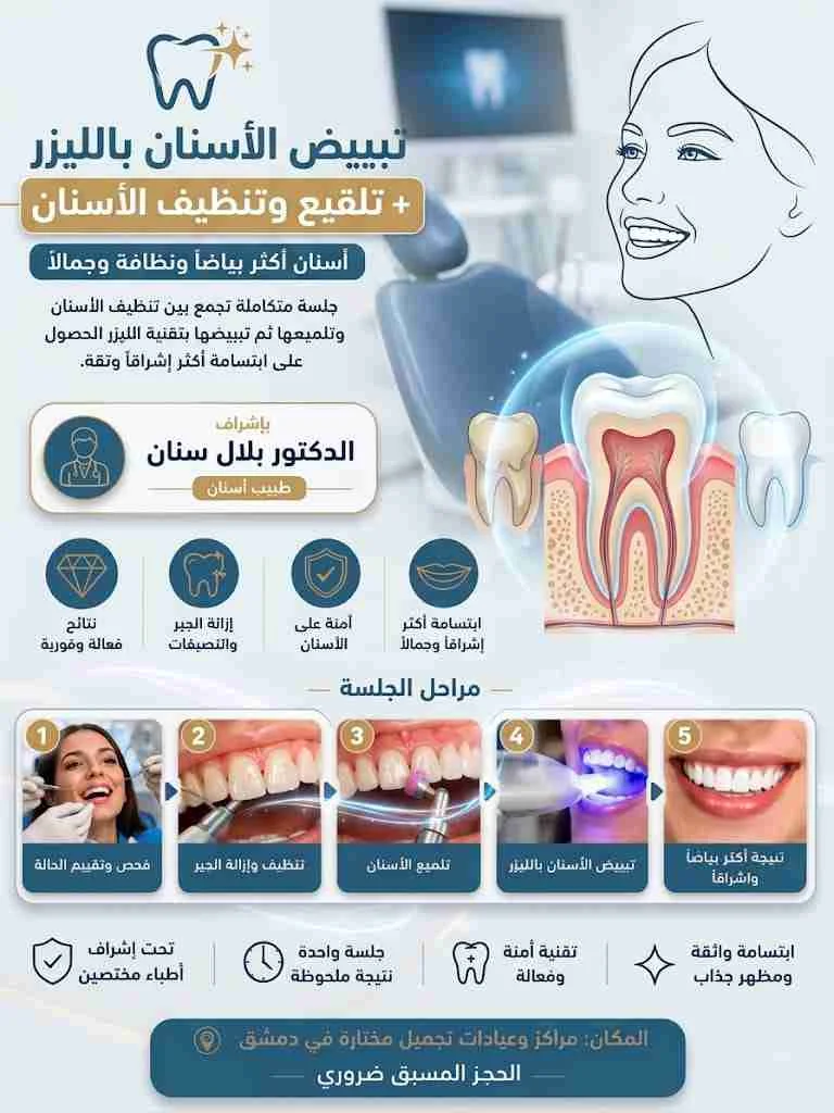 تبييض اسنان - دمشق